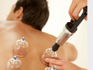 Curso de Ventosaterapia